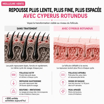 Rasez-vous 3× moins souvent — sans laser, sans rendez-vous.