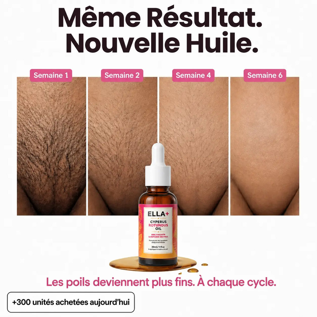Rasez-vous 3× moins souvent — sans laser, sans rendez-vous.