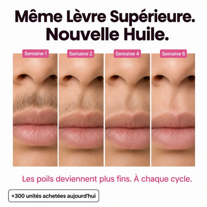 Rasez-vous 3× moins souvent — sans laser, sans rendez-vous.