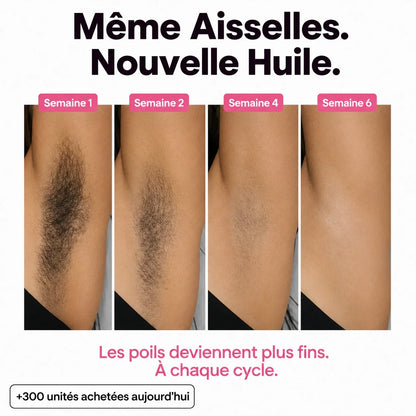 Rasez-vous 3× moins souvent — sans laser, sans rendez-vous.